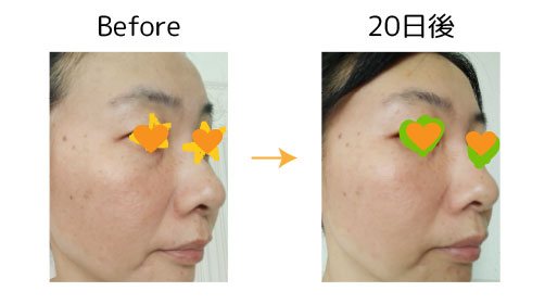 fuku1 fuku スキンケア モニター