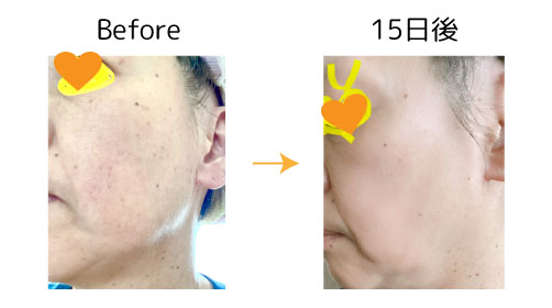 fuku2 fuku スキンケア モニター