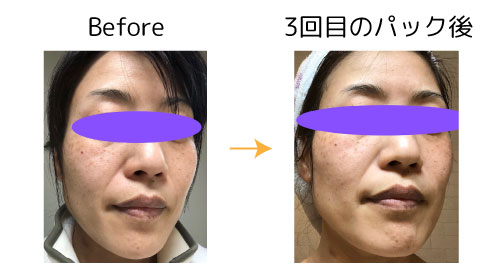 fuku3 fuku スキンケア モニター