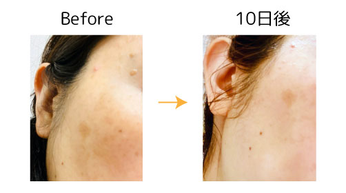 fuku4 fuku スキンケア モニター