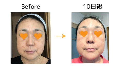 fuku5 fuku スキンケア モニター