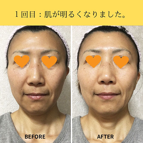 fuku6a fuku スキンケア モニター