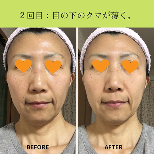 fuku6b fuku スキンケア モニター