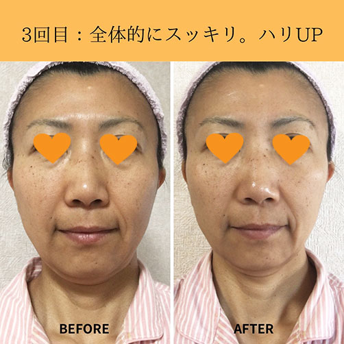 fuku6c fuku スキンケア モニター