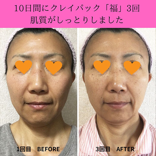 fuku6d fuku スキンケア モニター